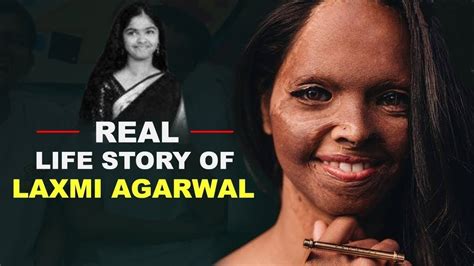 Overcoming Adversity: Laxmi Agarwal's Inspiring Journey